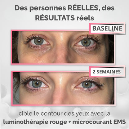 RevitalEyes - Thérapie par Lumière Rouge Pour le Contour des Yeux