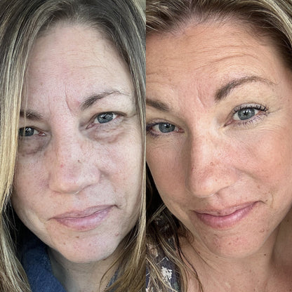 RevitalEyes - Thérapie par Lumière Rouge Pour le Contour des Yeux